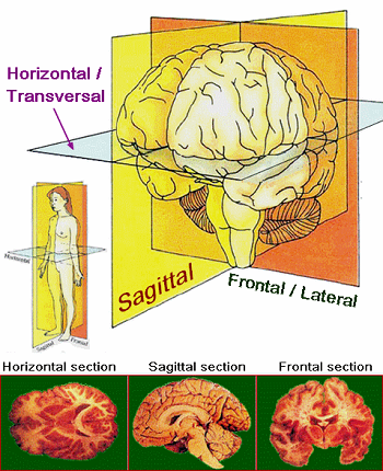 www.dementia-devotion.com Corticobasal Degeneration